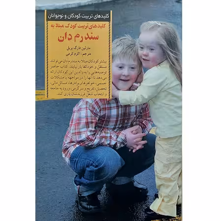 کلید های تربیت کودک مبتلا به سندرم دان