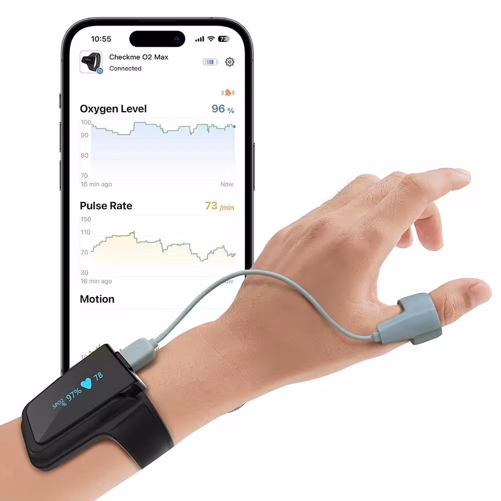 پالس اکسیمتر هوشمند برند Wellue Checkme 02 Max