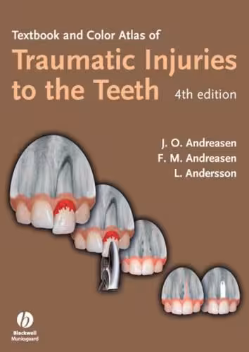 خرید و دانلود نسخه کامل کتاب Textbook and Color Atlas of Traumatic Injuries to the Teeth