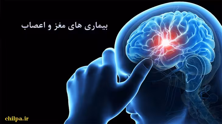 پاورپوینت انواع بیماریهای عصبی - چیلپا