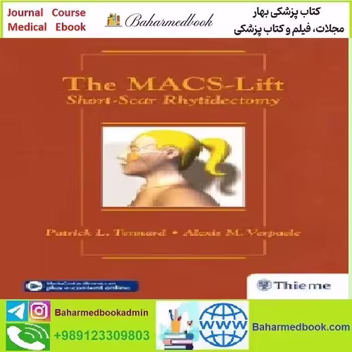 The Macs lift Short Scar Rhytidectomy TRUE PDF price 1€ - کتاب پزشکی بهار