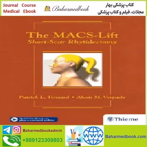 The Macs lift Short Scar Rhytidectomy TRUE PDF price 1€ - کتاب پزشکی بهار