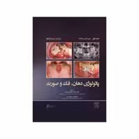 کتاب پاتولوژی دهان، فک و صورت نویل 2024 جلد اول