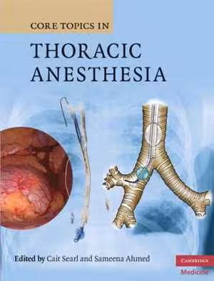 [PDF] دانلود کتاب Core Topics In Thoracic Anesthesia, 2009