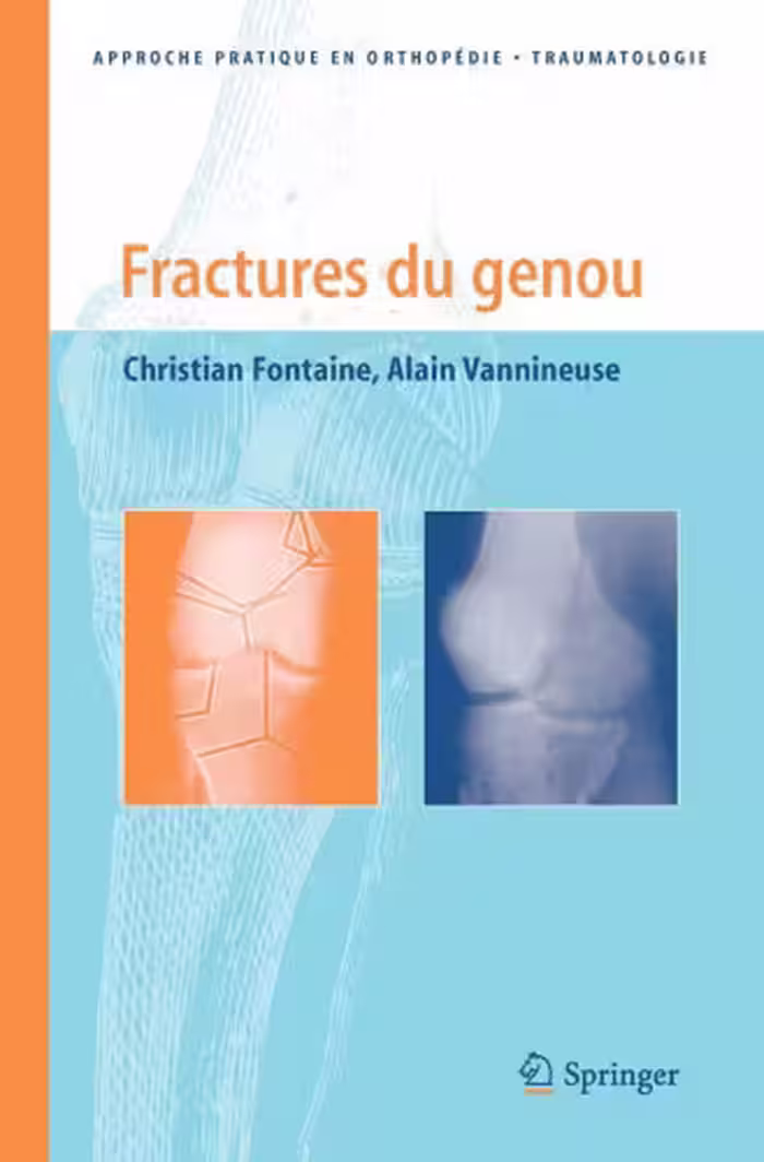 خرید و دانلود نسخه کامل کتاب Fractures du genou (Approche pratique en orthopedie-traumatologie)