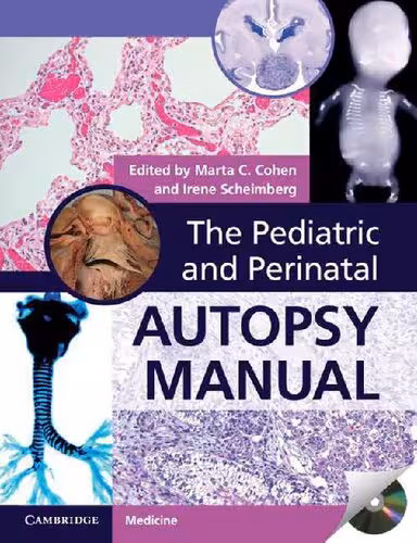 خرید و دانلود نسخه کامل کتاب The Pediatric and Perinatal Autopsy Manual with DVD-ROM