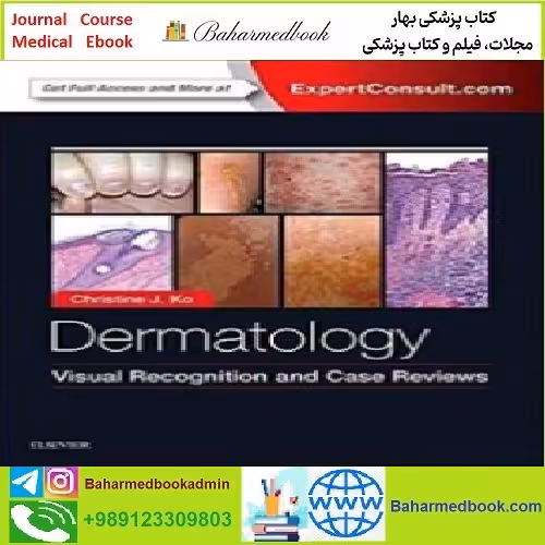 Dermatology Visual Recognition and Case Reviews TRUE PD