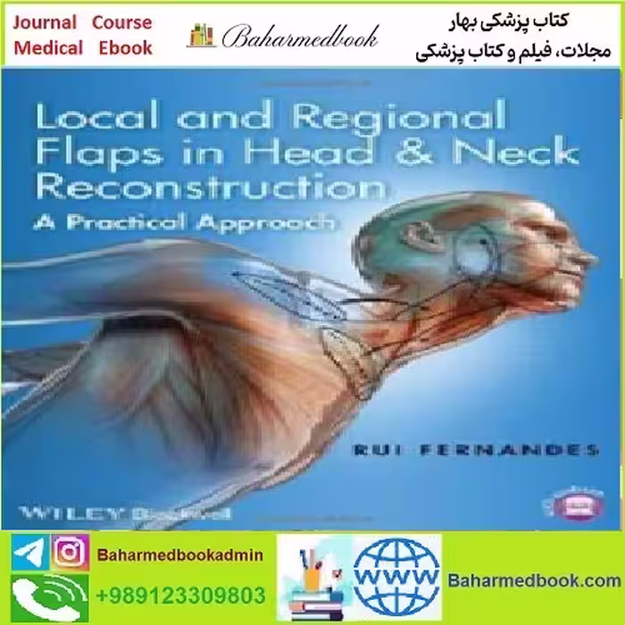 Local and Regional Flaps in Head &amp; Neck Reconstruction TRUE
