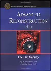 خرید و دانلود نسخه کامل کتاب Advanced Reconstruction Hip