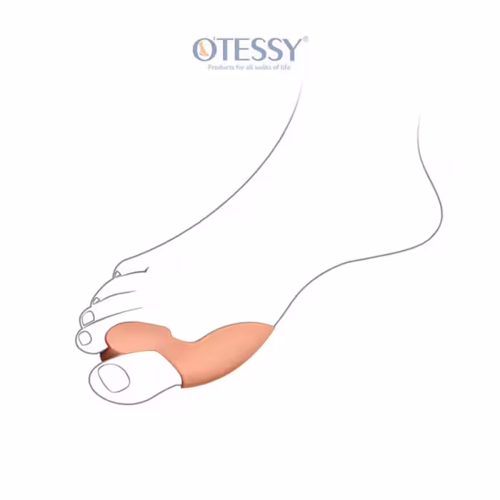 پد فاصله دهنده تک انگشت با ساپورت شست سیلیکونی مدل TF03 اتسی OTESSY