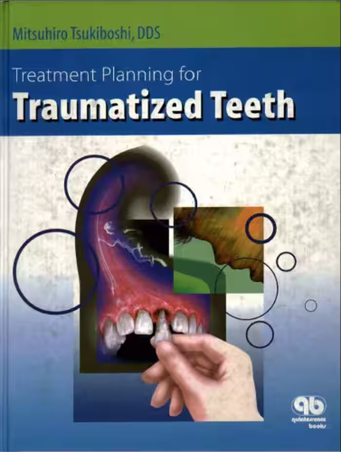 خرید و دانلود نسخه کامل کتاب Treatment Planning for Traumatized Teeth