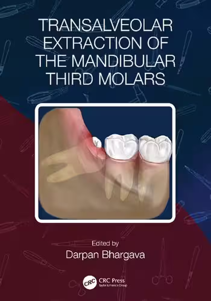 خرید و دانلود نسخه کامل کتاب Transalveolar Extraction of the Mandibular Third Molars