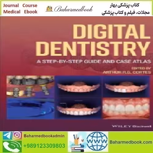Digital Dentistry A Step by Step Guide and Case Atlas 2022 T