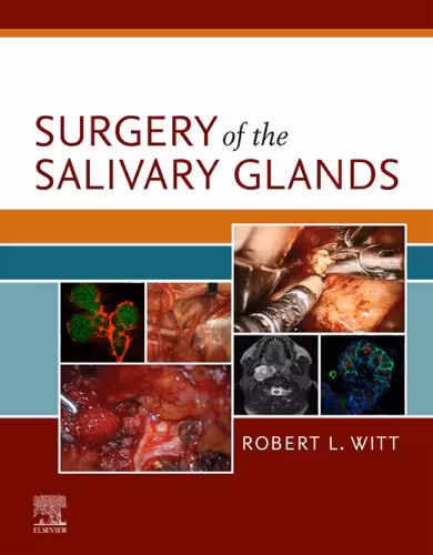 خرید و دانلود نسخه کامل کتاب Surgery of the Salivary Glands