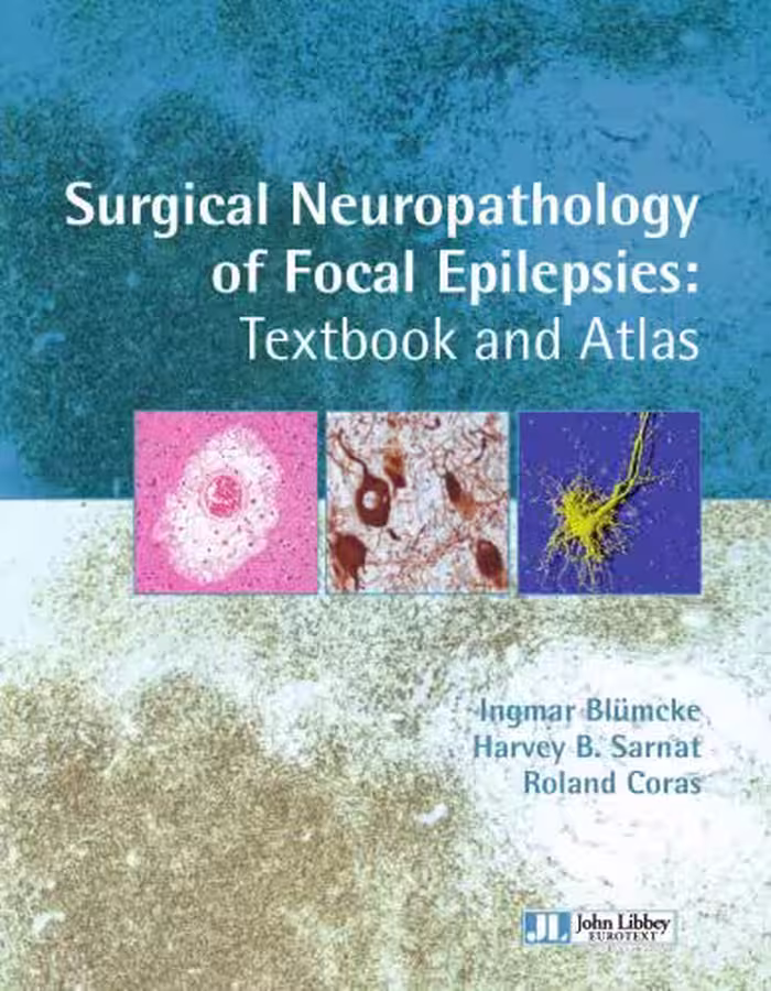 خرید و دانلود نسخه کامل کتاب Surgical Neuropathology of Focal Epilepsies