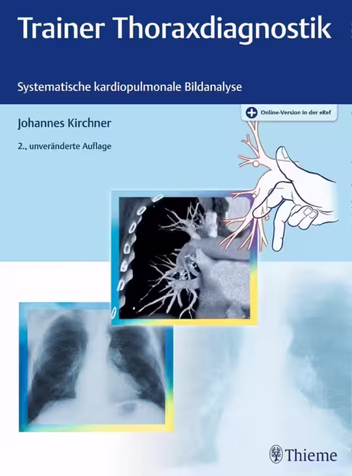 خرید و دانلود نسخه کامل کتاب Trainer Thoraxdiagnostik: Systematische kardiopulmonale Bildanalyse - Orginal Pdf