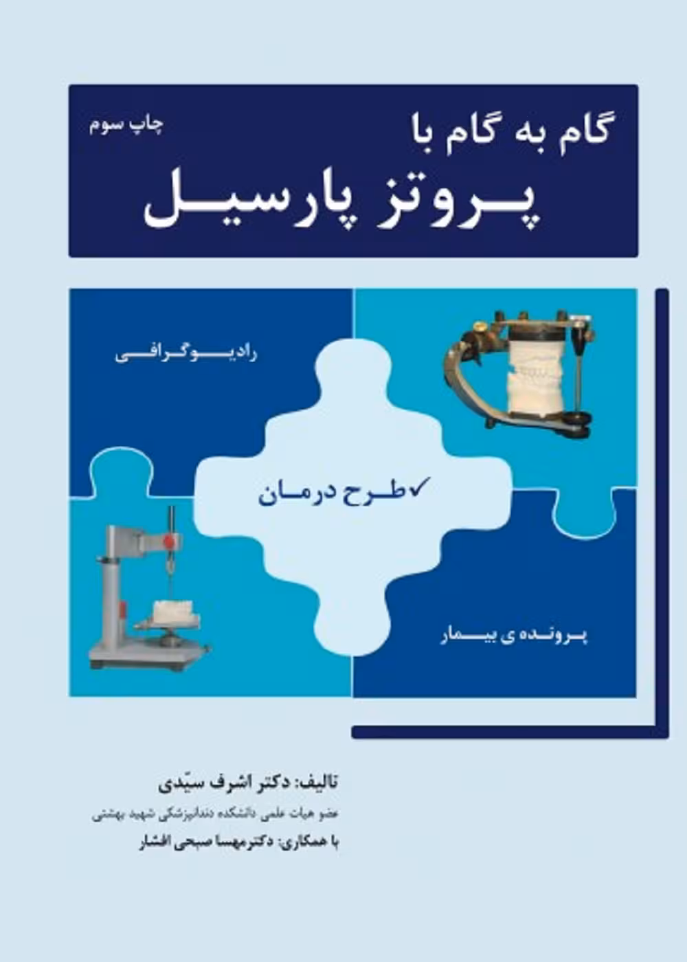 گام به گام با پروتز پارسیل
