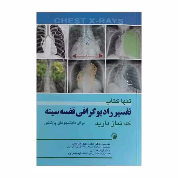 تنها کتاب تفسیر رادیوگرافی قفسه سینه که نیاز دارید (برای دانشجویان پزشکی)