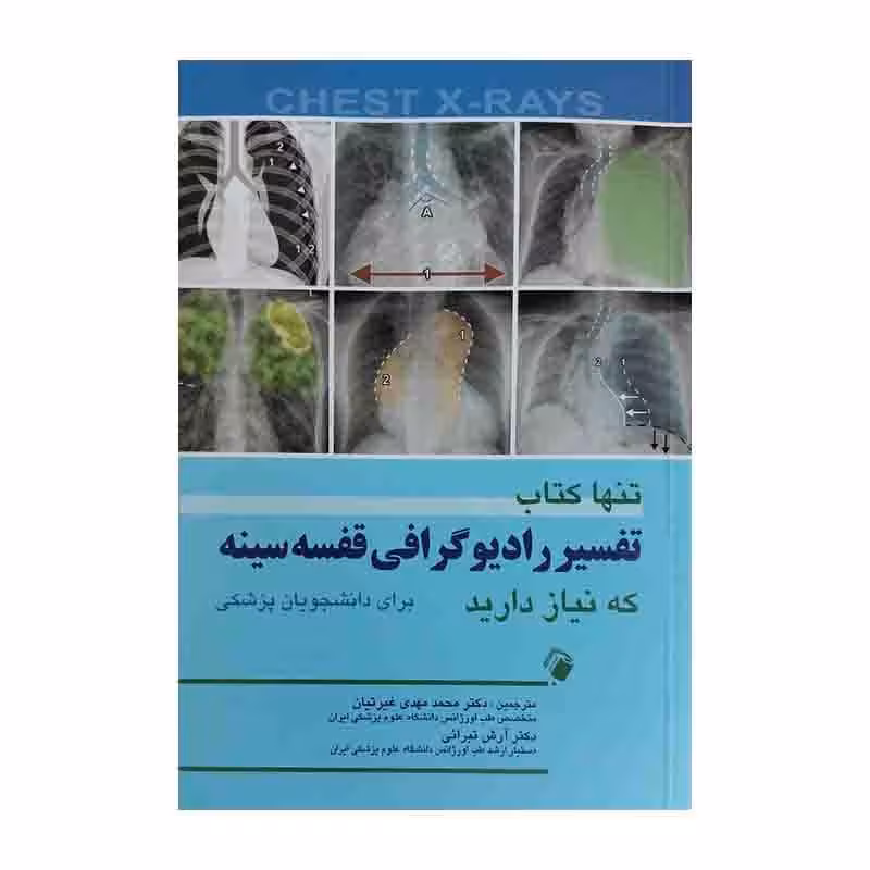 تنها کتاب تفسیر رادیوگرافی قفسه سینه که نیاز دارید (برای دانشجویان پزشکی)