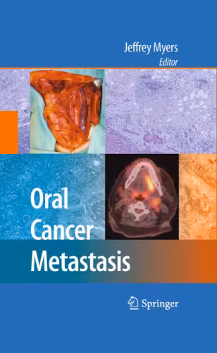 خرید و دانلود نسخه کامل کتاب Oral Cancer Metastasis