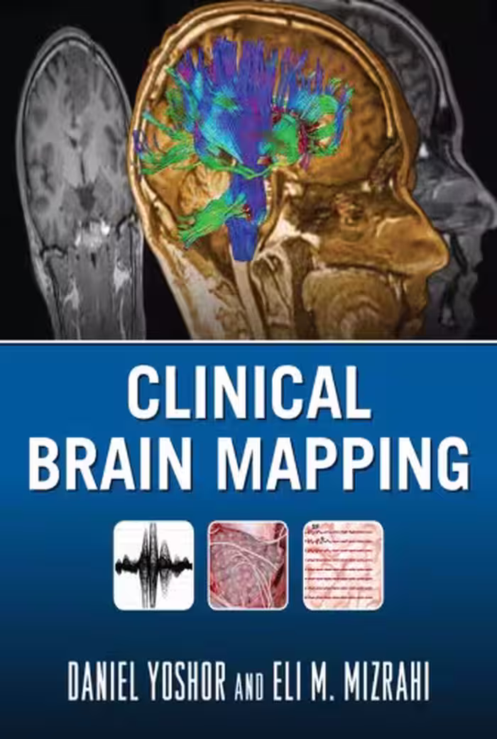 خرید و دانلود نسخه کامل کتاب Clinical Brain Mapping