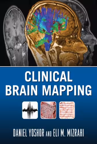 خرید و دانلود نسخه کامل کتاب Clinical Brain Mapping