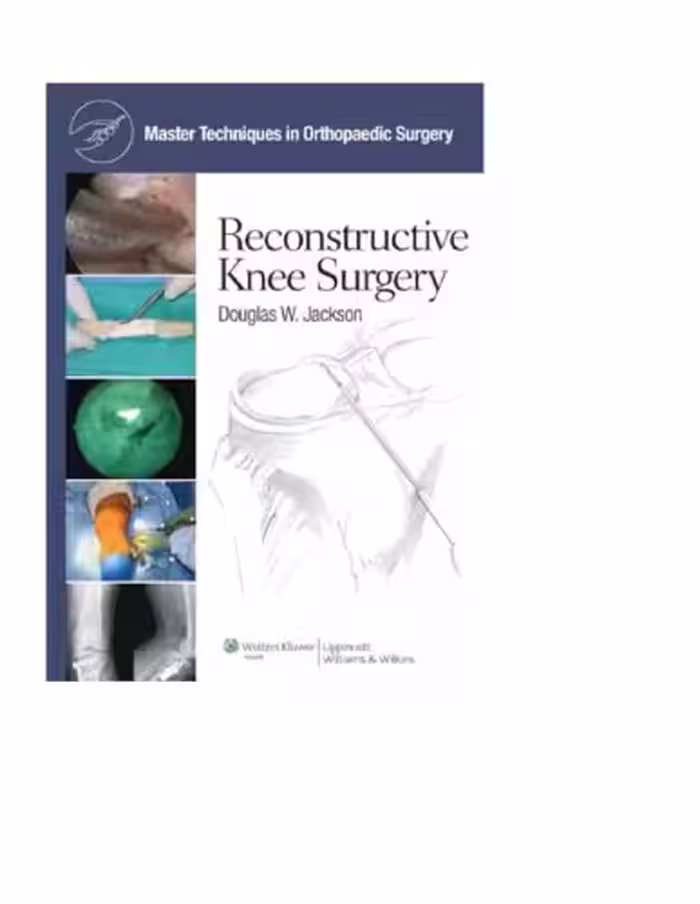 خرید و دانلود نسخه کامل کتاب Master Techniques in Orthopaedic Surgery Reconstructive Knee Surgery