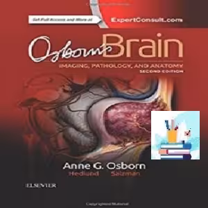 Osborn‘s Brain TRUE PDF price 1€