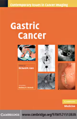 خرید و دانلود نسخه کامل کتاب 100 Q&amp;A About Gastric Cancer (100 Questions &amp; Answers about . . .) (100 Questions and Answers)
