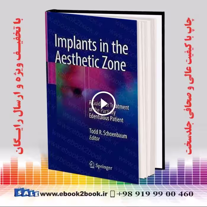 Implants in the Aesthetic Zone