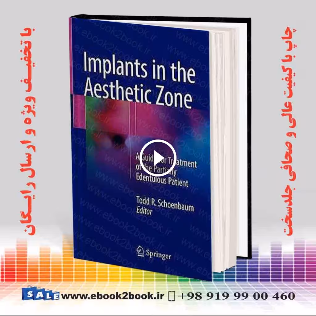 Implants in the Aesthetic Zone