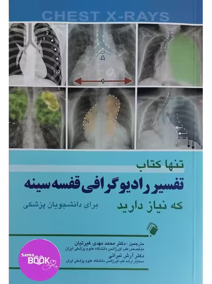 تنها کتاب تفسیر رادیوگرافی قفسه سینه که نیاز دارید (برای دانشجویان پزشکی)