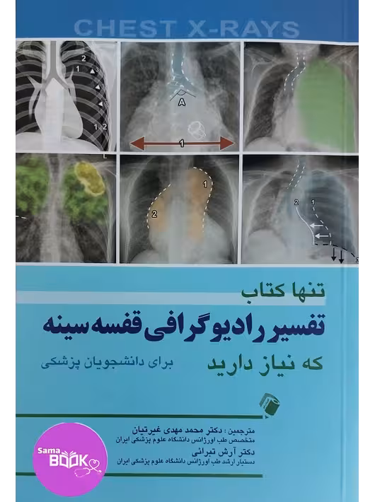 تنها کتاب تفسیر رادیوگرافی قفسه سینه که نیاز دارید (برای دانشجویان پزشکی)