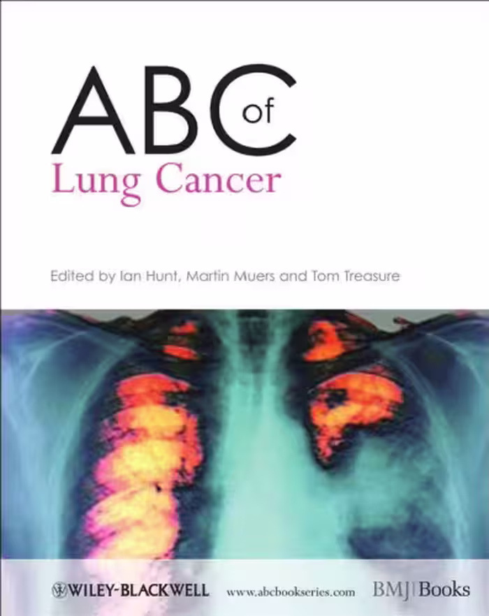 خرید و دانلود نسخه کامل کتاب ABC of Lung Cancer (ABC Series)