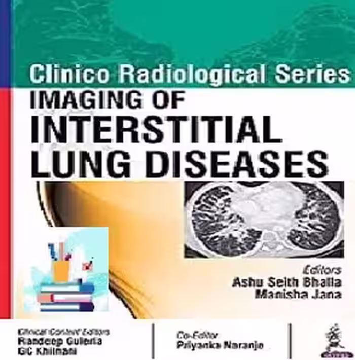 Clinico Radiological Series Imaging of Interstitial Lung Diseases
