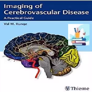 Imaging of Cerebrovascular Disease TRUE PDF price 1€