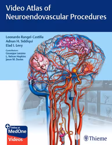 خرید و دانلود نسخه کامل کتاب Video Atlas of Neuroendovascular Procedures