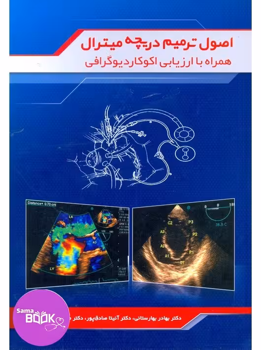 اصول ترمیم دریچه میترال همراه با ارزیابی اکوکاردیوگرافی