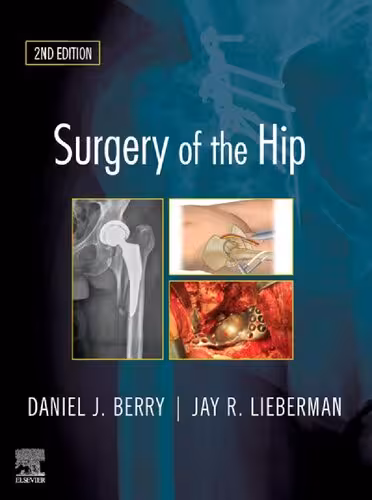خرید و دانلود نسخه کامل کتاب Surgery of the Hip