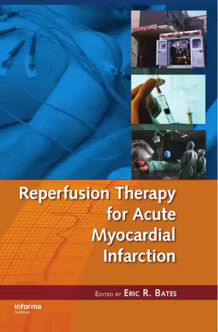 خرید و دانلود نسخه کامل کتاب Reperfusion Therapy for Acute Myocardial Infarction (Fundamental and Clinical Cardiology)
