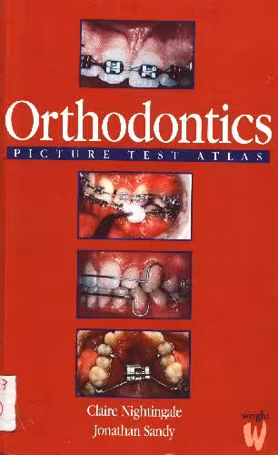 خرید و دانلود نسخه کامل کتاب orthodontics picture test atlas