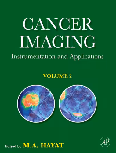 خرید و دانلود نسخه کامل کتاب Cancer Imaging, Volume 2: Instrumentation and Applications
