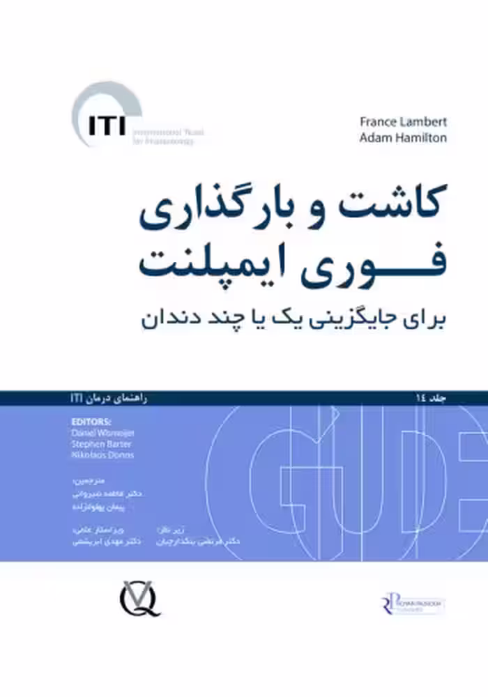 کاشت و بارگذاری فوری ایمپلنت برای جایگزینی یک یا چند دندان جلد 14