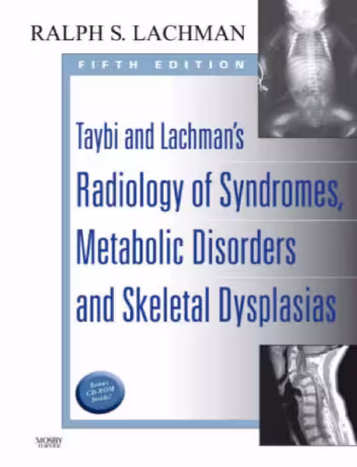 خرید و دانلود نسخه کامل کتاب Taybi and Lachman’s Radiology of Syndromes, Metabolic Disorders and Skeletal Dysplasias