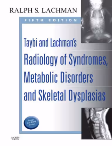 خرید و دانلود نسخه کامل کتاب Taybi and Lachman’s Radiology of Syndromes, Metabolic Disorders and Skeletal Dysplasias