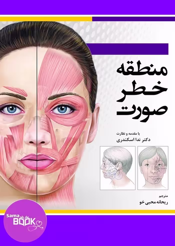 منطقه خطر صورت