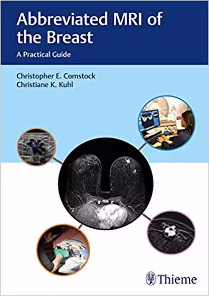 خرید و دانلود نسخه کامل کتاب Abbreviated MRI of the Breast A Practical Guide