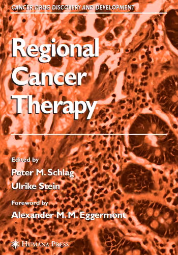 خرید و دانلود نسخه کامل کتاب Regional Cancer Therapy (Cancer Drug Discovery and Development)