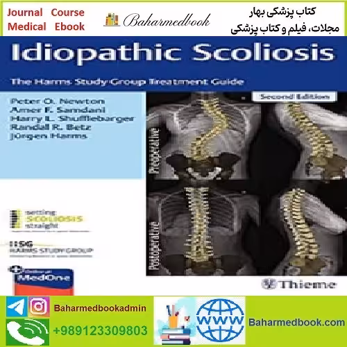 Idiopathic Scoliosis TRUE PDF price 1€ - کتاب پزشکی بهار