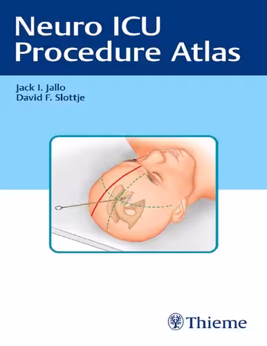 خرید و دانلود نسخه کامل کتاب Neuro ICU Procedure Atlas